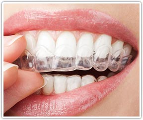 Orthodontic