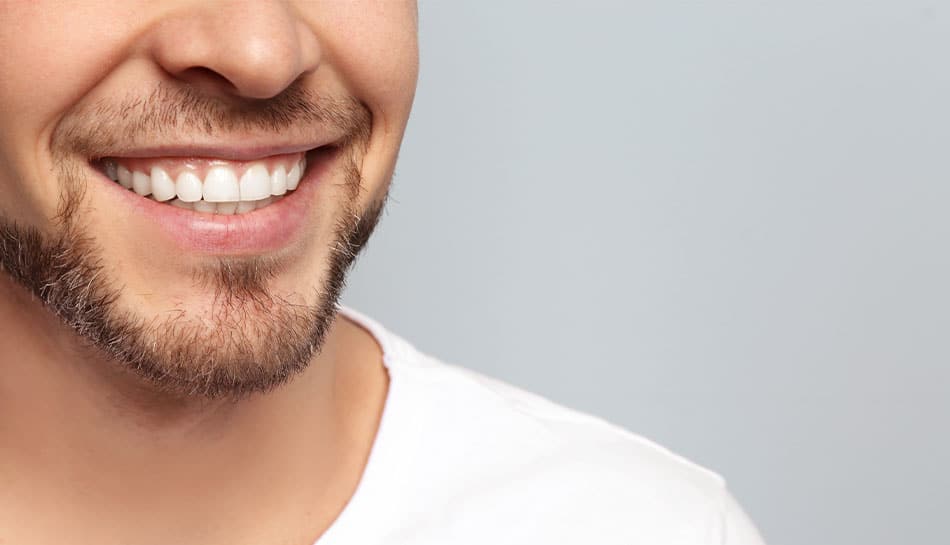 Safarian Dental Bonding min