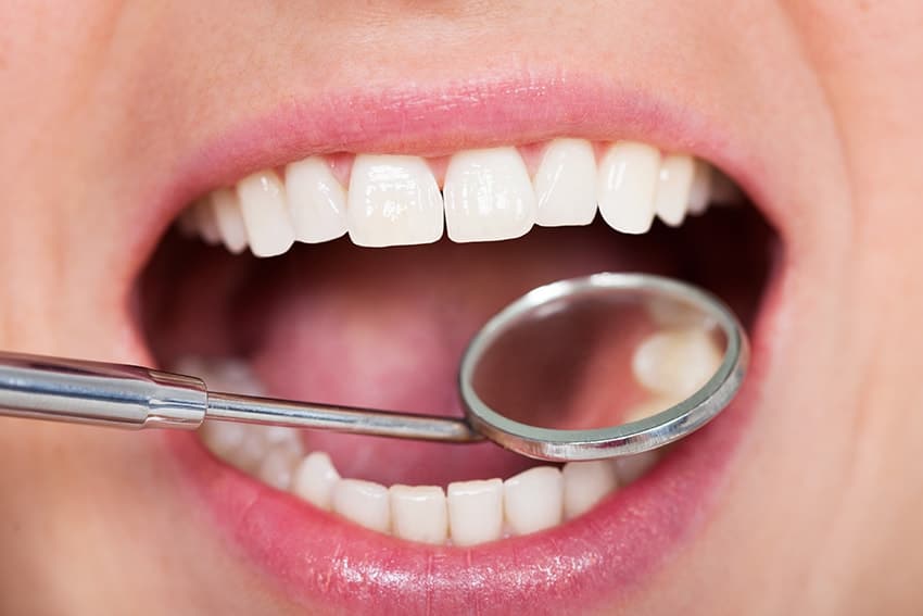 faqs about cancer treatments and oral health 63f3d81d6a820