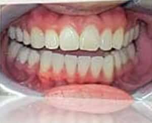 After Image: Smile Makeover