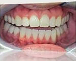 After Image: Smile Makeover