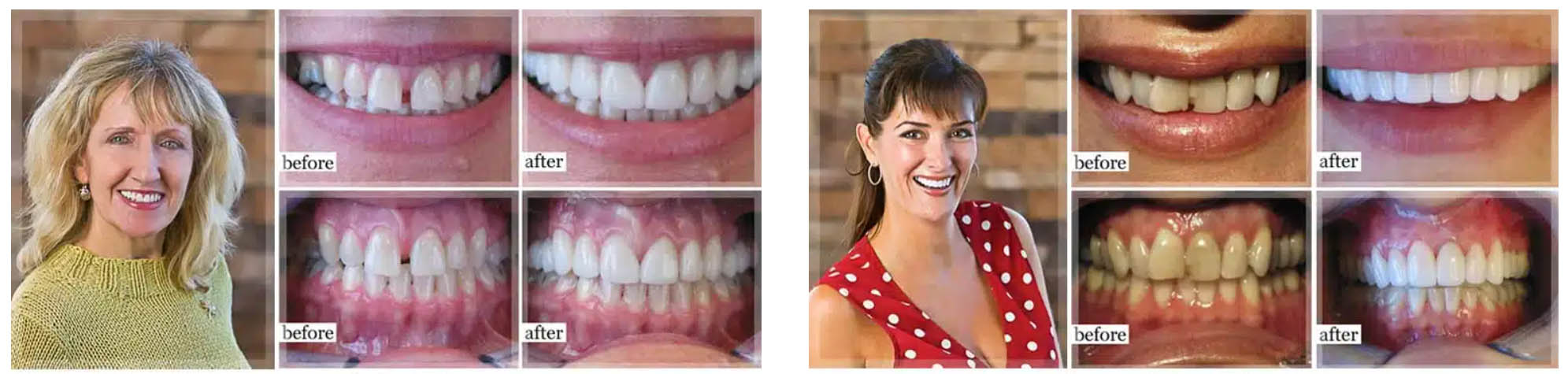 before and after